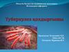 Туберкулез қоздырғышы