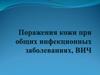 Поражения кожи при общих инфекционных заболеваниях, ВИЧ