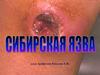 Сибирская язва