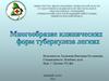 Многообразие клинических форм туберкулеза легких