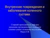 Внутренние повреждения и заболевания коленного сустава