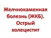 Желчнокаменная болезнь (ЖКБ). Острый холецистит