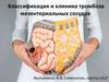 Классификация и клиника тромбоза мезентериальных сосудов
