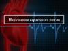 Нарушения сердечного ритма