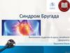 Синдром Бругада