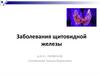 Заболевания щитовидной железы