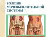 Болезни мочевыделительной системы