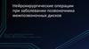 Нейрохирургические операции при заболевании позвоночника межпозвоночных дисков