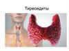 Тиреоидиты. Классификация