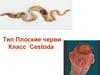 Тип Плоские черви. Класс Cestoda