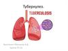 Туберкулез. Причины заболевания и пути заражения