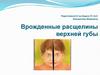 Врожденные расщелины верхней губы