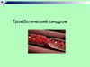 Тромботический синдром