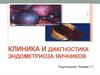 Клиника и диагностика эндометриоза яичников