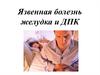 Язвенная болезнь желудка и ДПК