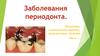 Заболевания периодонта