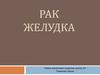 Рак желудка