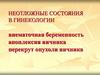 Внематочная беременность. Апоплексия яичника. Перекрут опухоли яичника