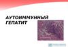 Аутоиммунный гепатит