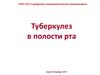 Туберкулез в полости рта