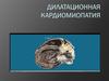 Дилатационная кардиомиопатия. Этиология