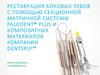 Реставрация боковых зубов с помощью секционной матричной системы Palodent® plus и композитных материалов компании Dentsply™