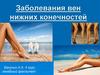 Заболевания вен нижних конечностей