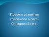 Пороки развития головного мозга. Синдром Веста
