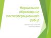 Нормальное образование послеоперационного рубца