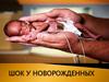 Шок у новорожденных