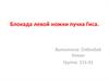 Блокада левой ножки пучка Гиса